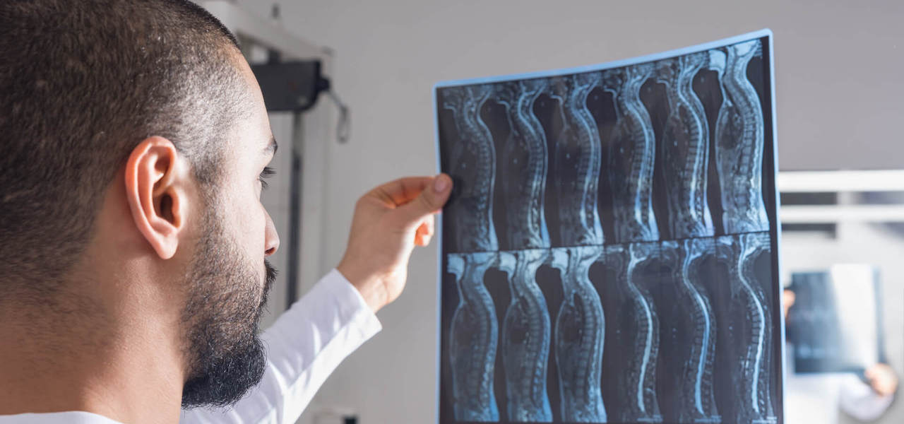 Spinal Cord Accident