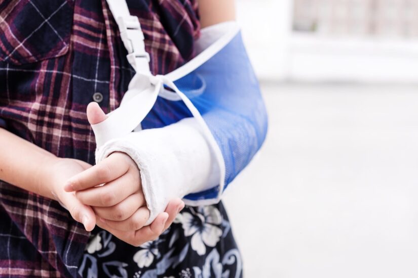Broken Arm